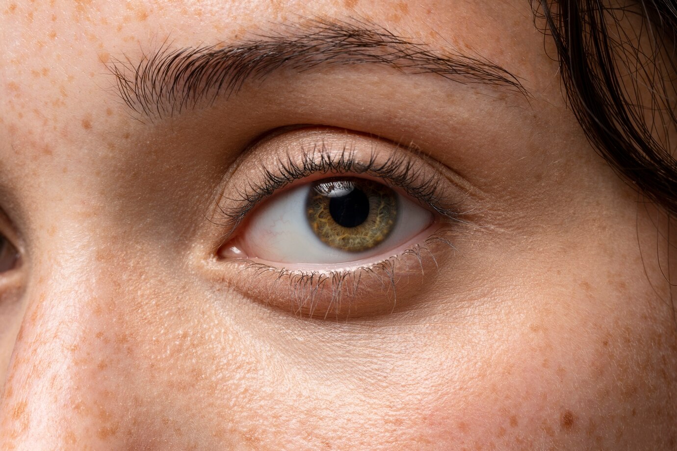 16 Alimentos Que Pioram o Melasma: O Que Evitar e Como Cuidar Melhor da Sua Pele